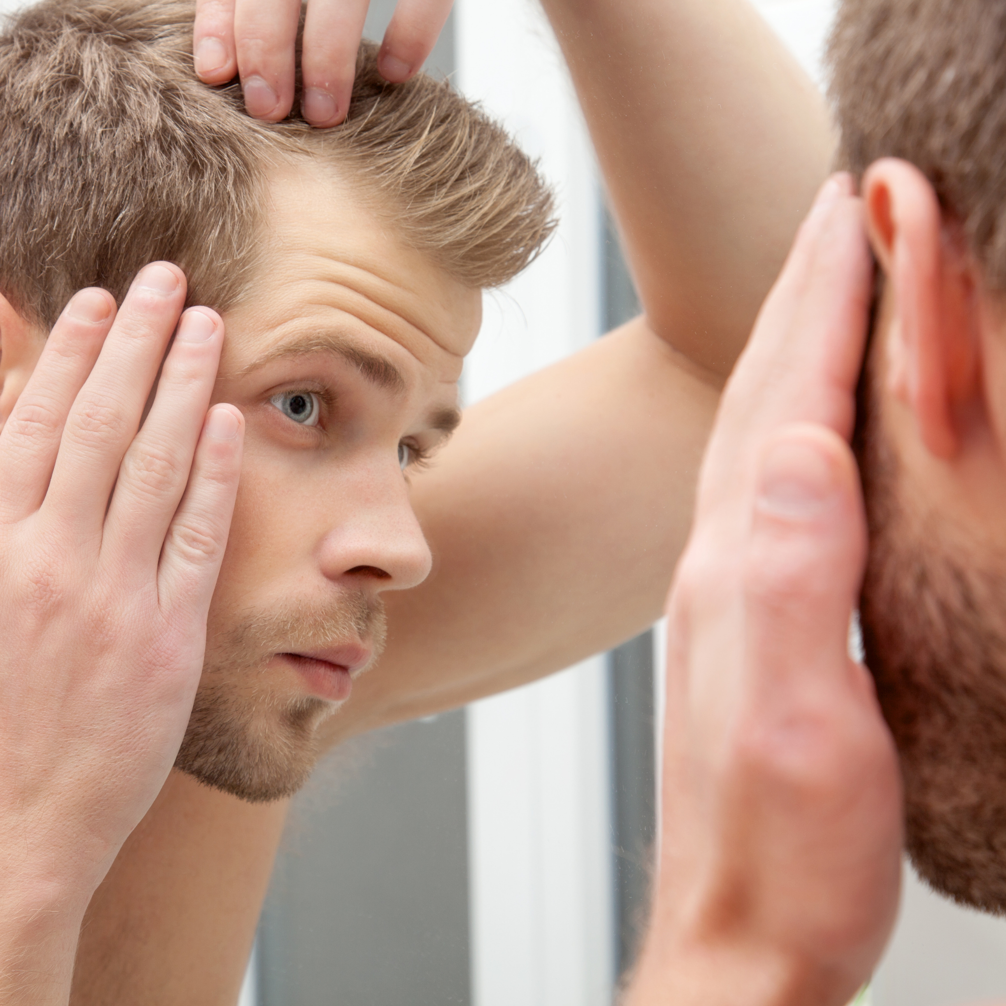 How to treat hair loss in men? – Chosen Store