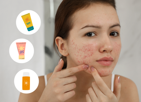 Allergies, irritation and acne with sunscreens