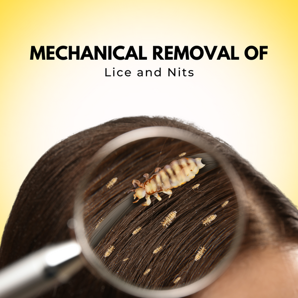 Mechanical Removal of Lice and Nits