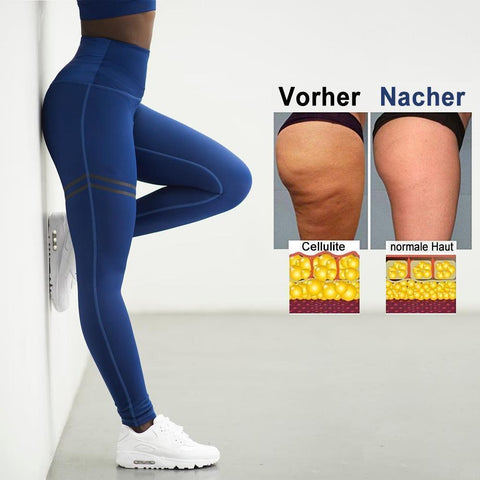 Deluxe™ Slim Fit Leggings fördert durch ihr Carbon Gewebe mit hoher Kompression die Durchblutung deiner Beine
