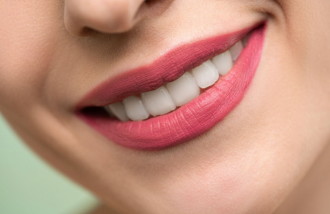 women smiling and showing her teeth