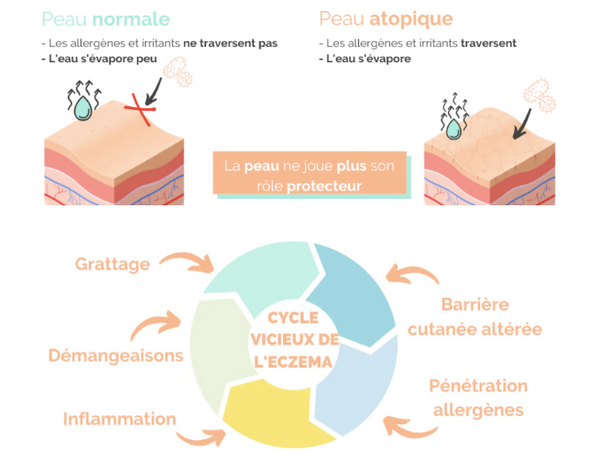 Image that represents the differences between normal skin and atopic skin and image of the vicious cycle of eczema