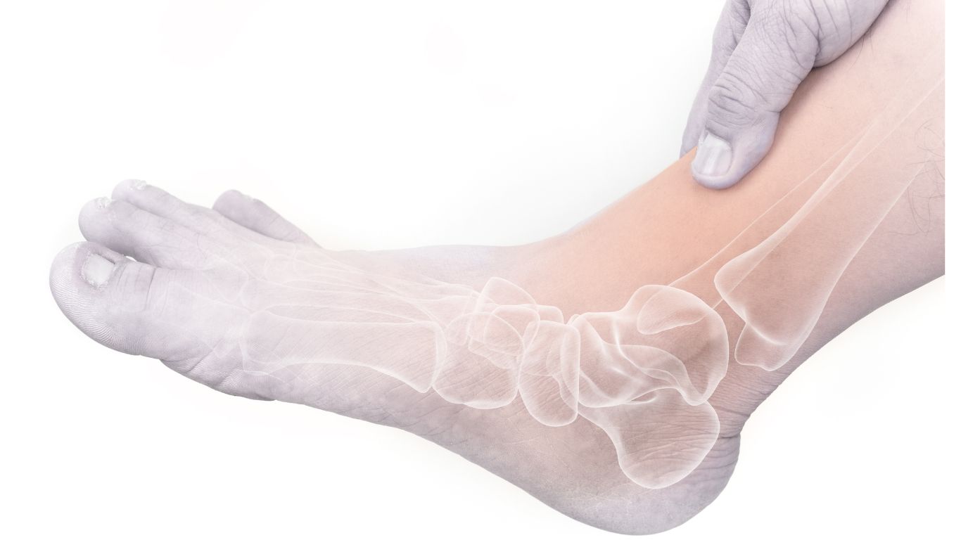 metatarsal pads