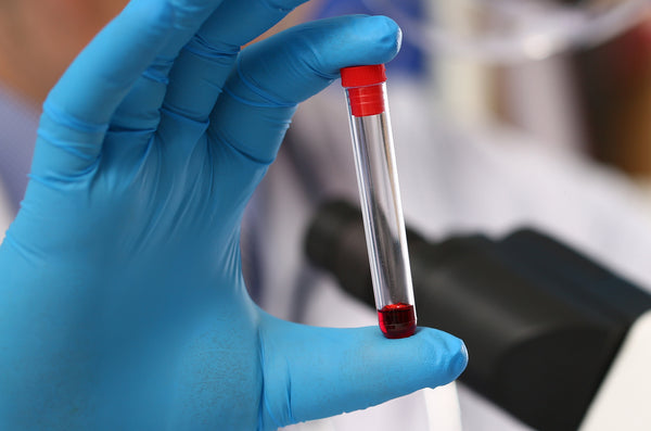 medical worker holding sample tube filled with blood