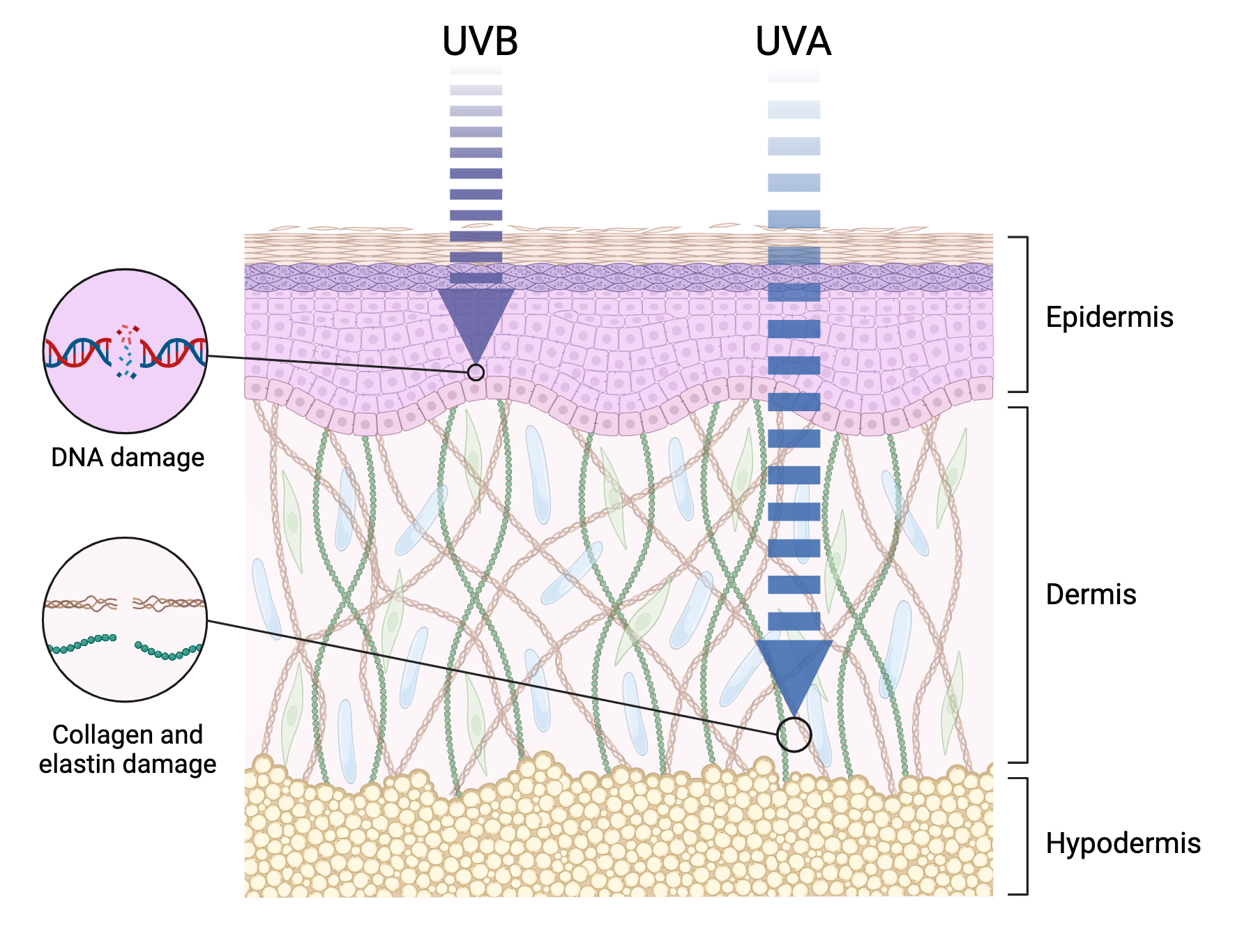 UV damage