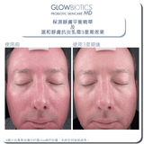 溫和靜膚抗炎乳霜 - Glowbiotics HK