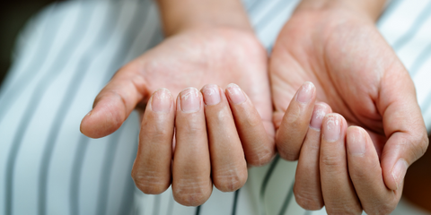 Brittled nails