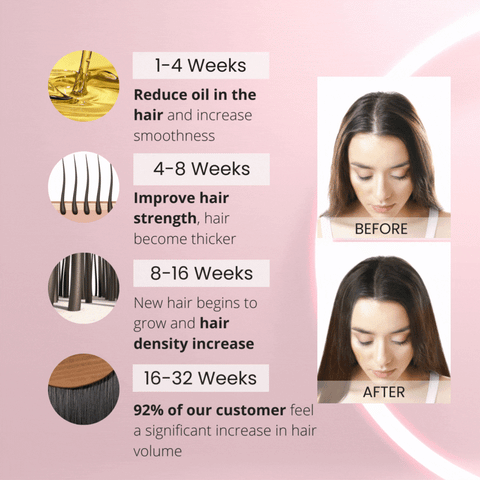 How an RF Hair Growth Laser Comb Works – winksbeaute