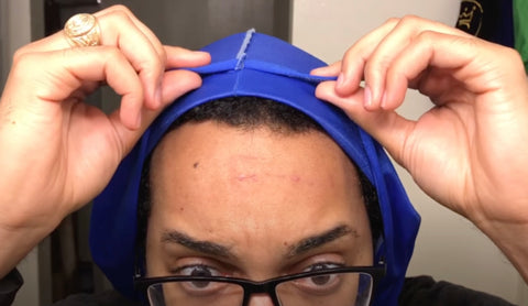 bumps on your forehead