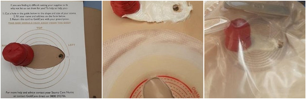 Need Help Removing Wafer! Adhesive Remover Not Working. Suggestions? -  Ostomy Forum Discussions