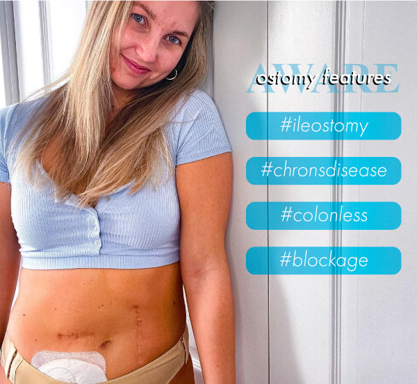 Chrons Disease Blog Feature Image