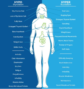 Hypothyroidism and Hyperthyroidism