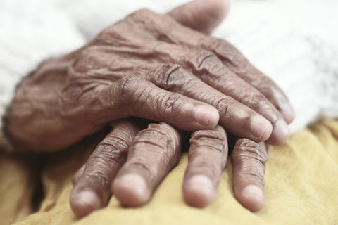 photo of a womans hands with arthritis