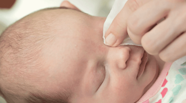 Conjuntivite bacteriana em bebês