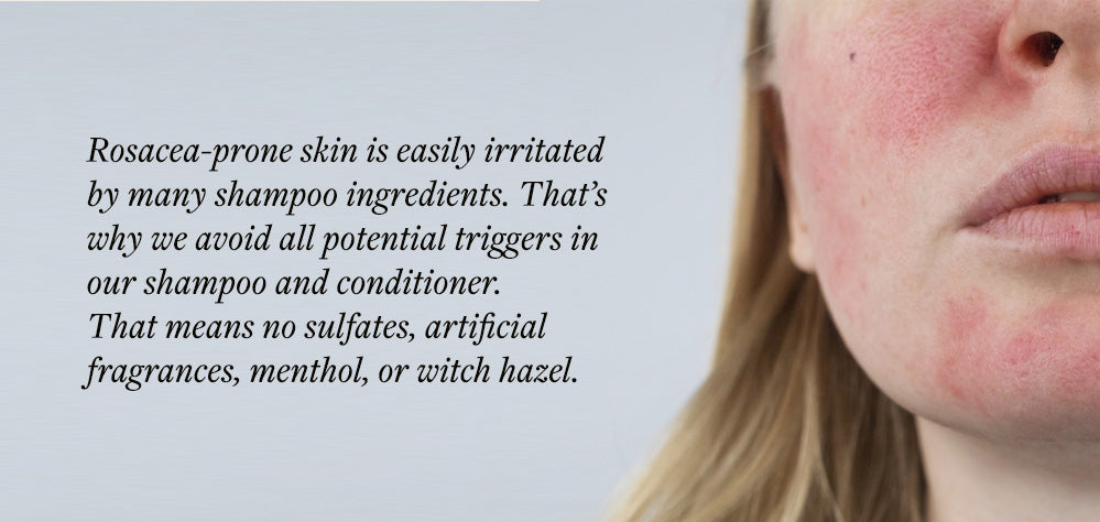 Woman with rosacea made worse by harmful shampoo ingredients