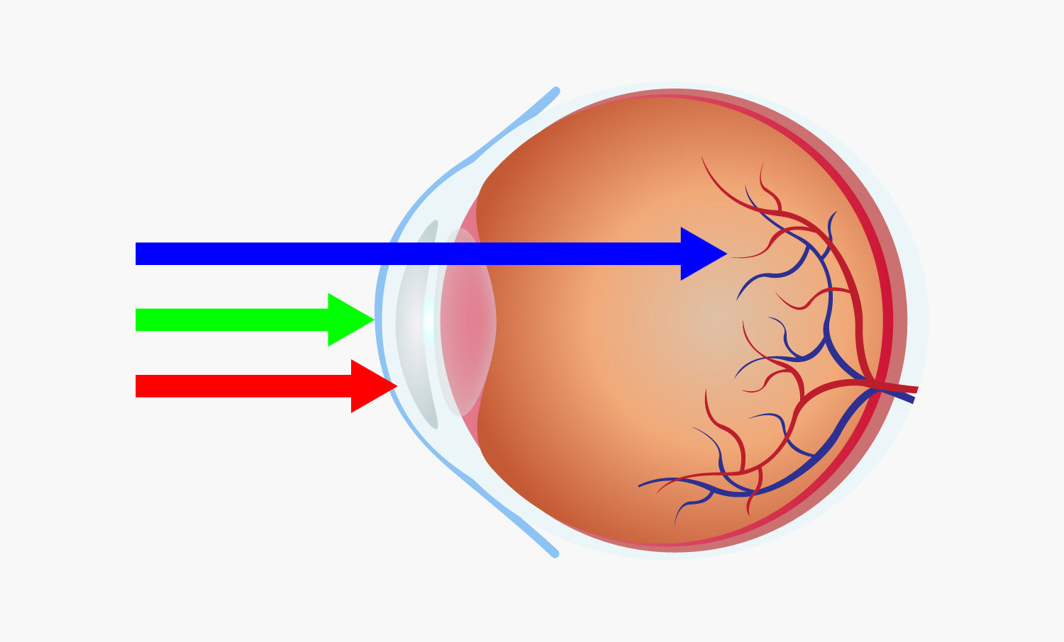 Blaues Licht trifft aufs Auge