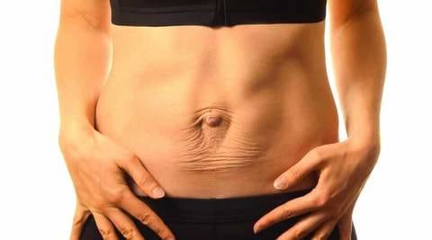 diastasis-enceinte-abdos-femme