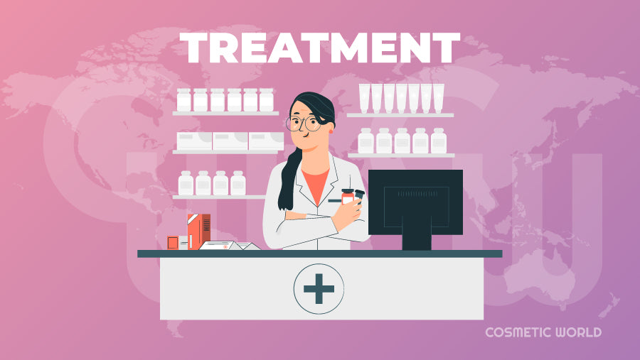 Treatment and Management of Dandruff - Infographic