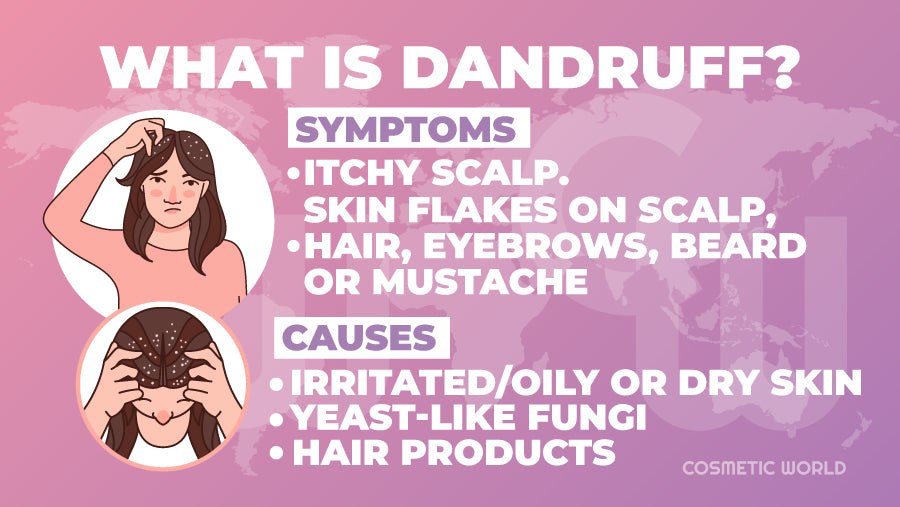 What is dandruff - Infographic
