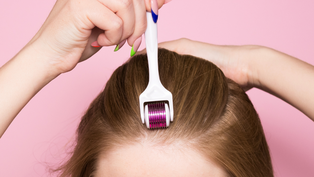 micro-needling for hair growth