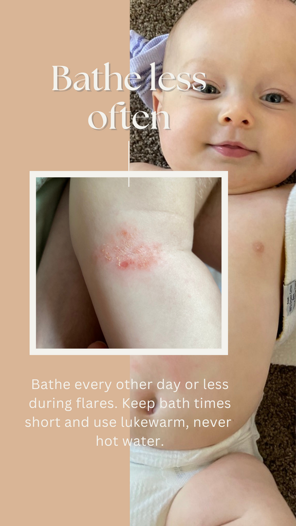 Baby eczema bath time tips. A step by step guide to bathing eczema prone babies.