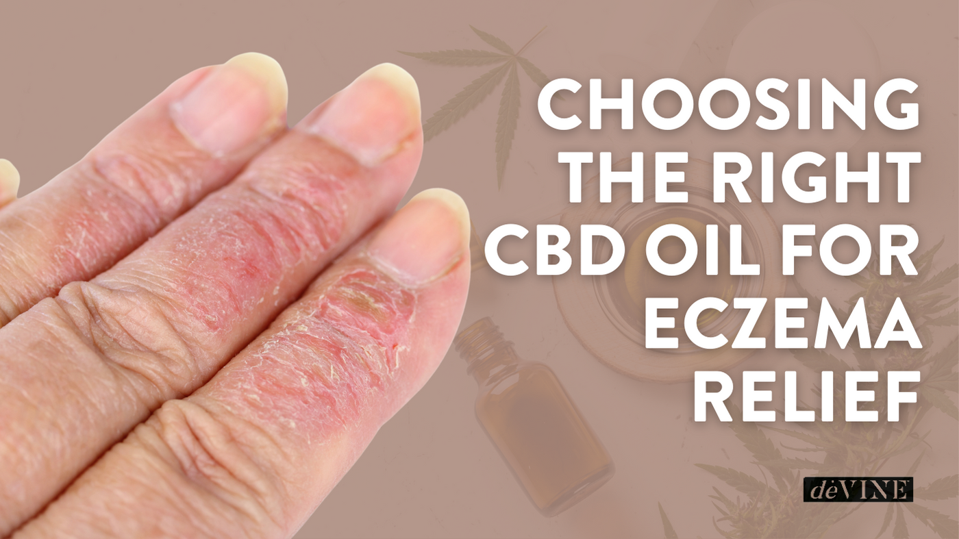 Choosing the Right CBD Oil for Eczema Relief