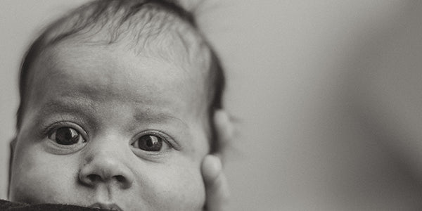 Newborn with cone-shaped head