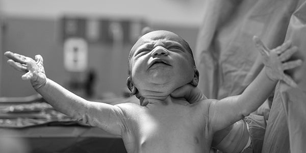 Newborn exhibiting the Moro reflex