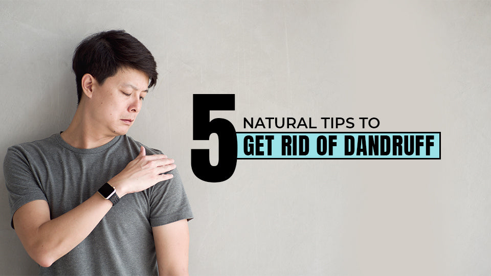 5 Natural Tips to Get Rid of Dandruff