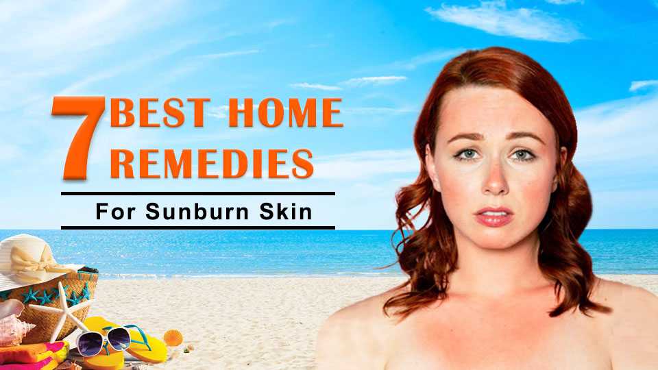 7 best  home remedies for sunburn skin
