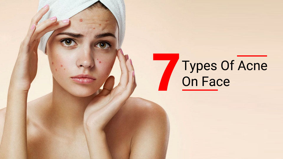 7 types of acne