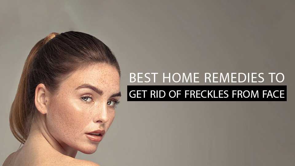 Best Home Remedies To Get Rid Of Freckles from Face - Vince