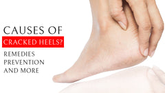 What Are The Causes of Cracked Heels? Remedies, Prevention and More