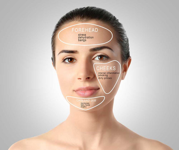 Causes of Acne On Face