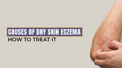 causes of dry skin eczema
