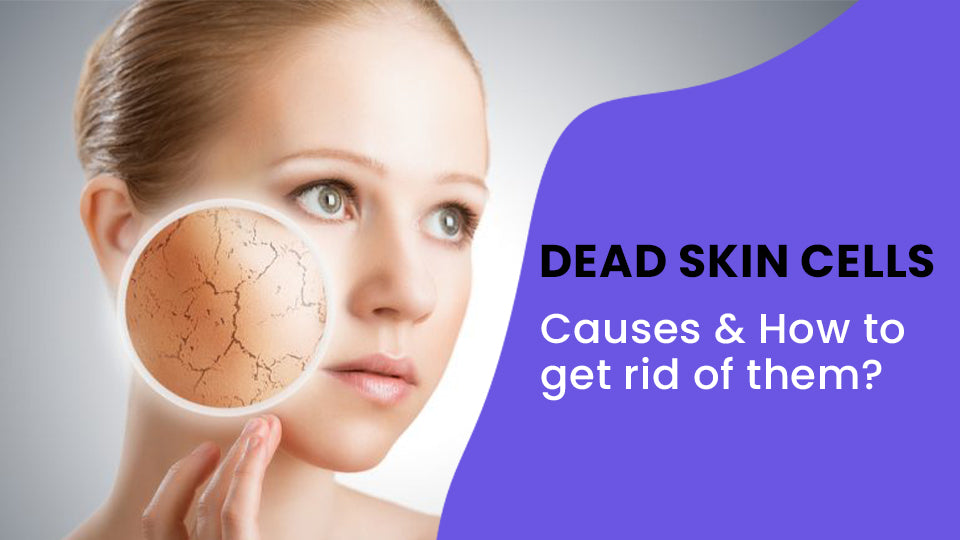 Dead Skin Cells - Causes & How to get rid of them?