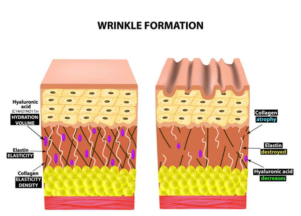 skin aging and wrinkles on skin