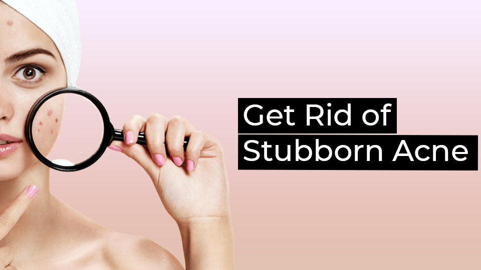 Get Rid of Stubborn Acne