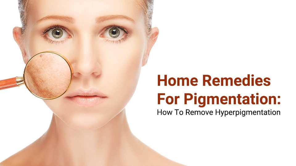 Home Remedies for pigmentation, How to Remove Hyperpigmentation