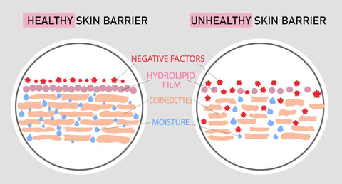 Skin Barrier Damage healthy & un healthy