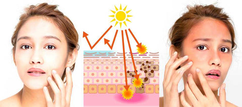 Sun UV rays penetrate in Skin and damage skin cells