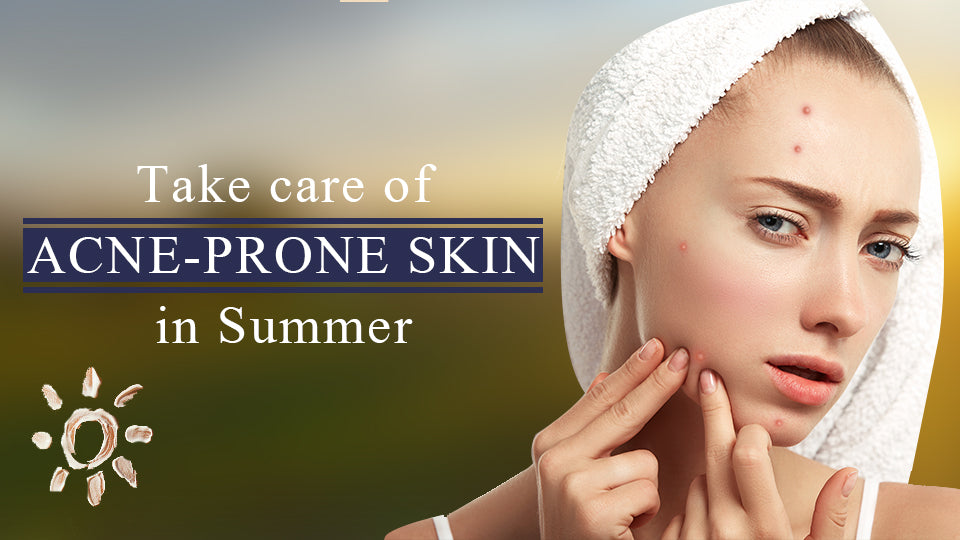Take care of Acne Prone Skin in Summer