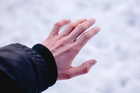 Dry hands in winter and make skin dry patchy 