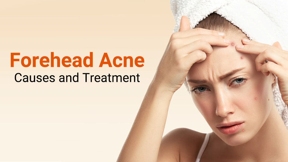 Causes Of Forehead Acne And Pimples Treatment And Prevention