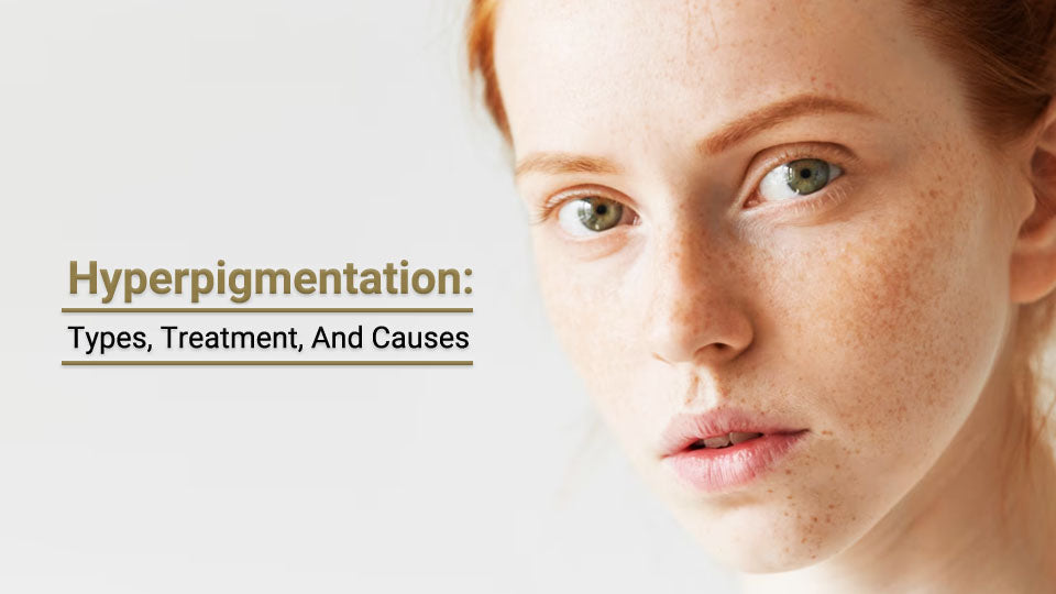 hyperpigmentation types , treatments and causes