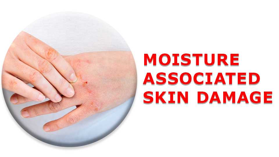 Best Treatment for Moisture Associated Skin Damage - Vince