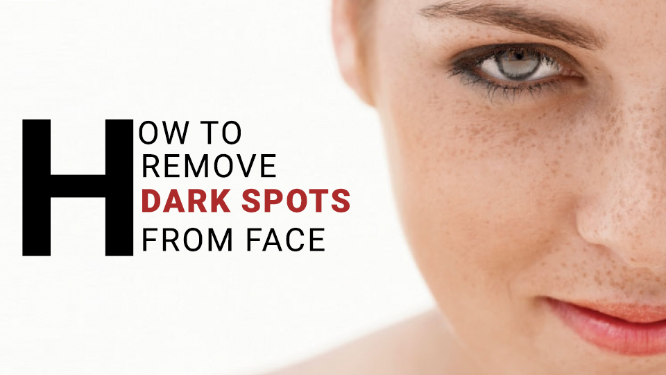 How to remove dark spots from face