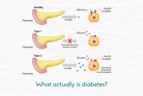 diabetes explained