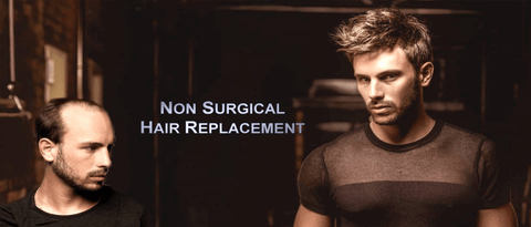 Best Hair Replacement Systems