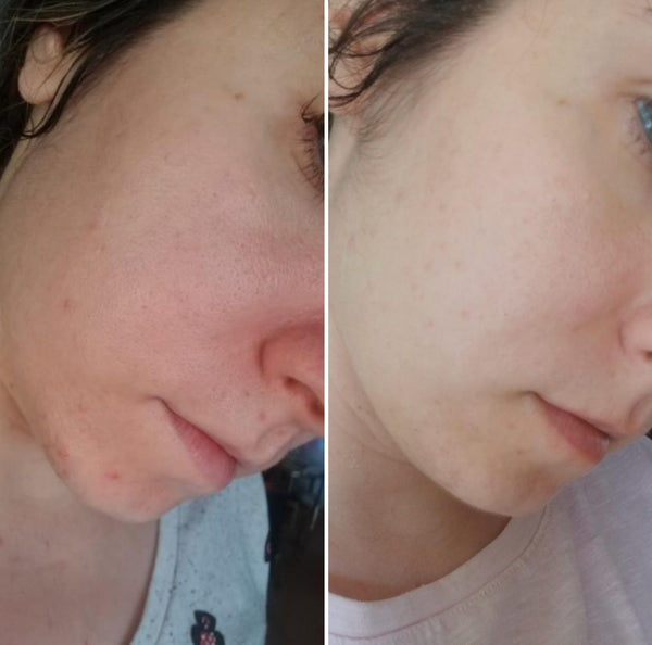 Before and After evening skin texture